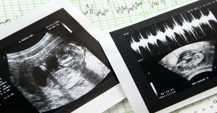 Pro-life groups and activists are celebrating a report from the pro-choice Guttmacher Institute